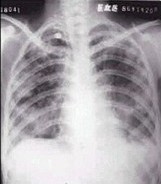 呼吸内科学(医学高级):诊断学基础考试试题(每