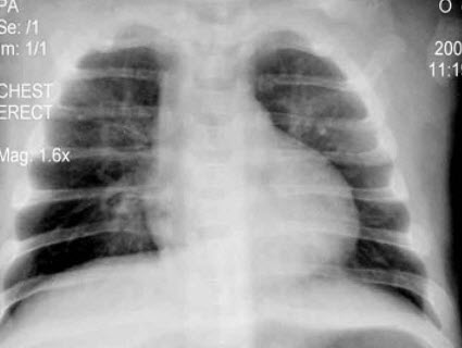 科(医学高级):十呼吸系统疾病考试题库(强化练