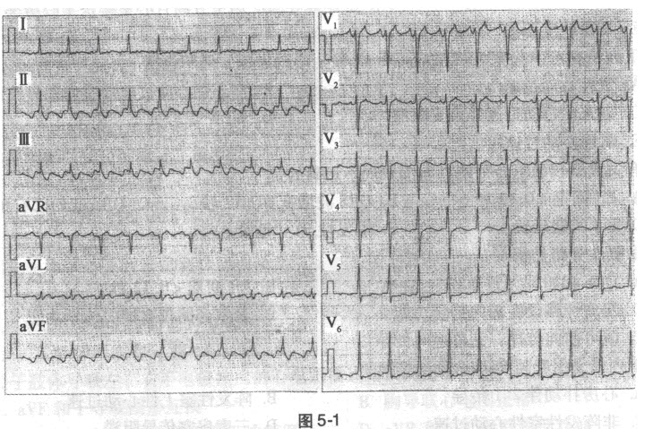 神经内科(医学高级):诊断学基础测试题(强化练