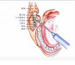 广西口腔住院医师规范化培训:口腔颌面外科学